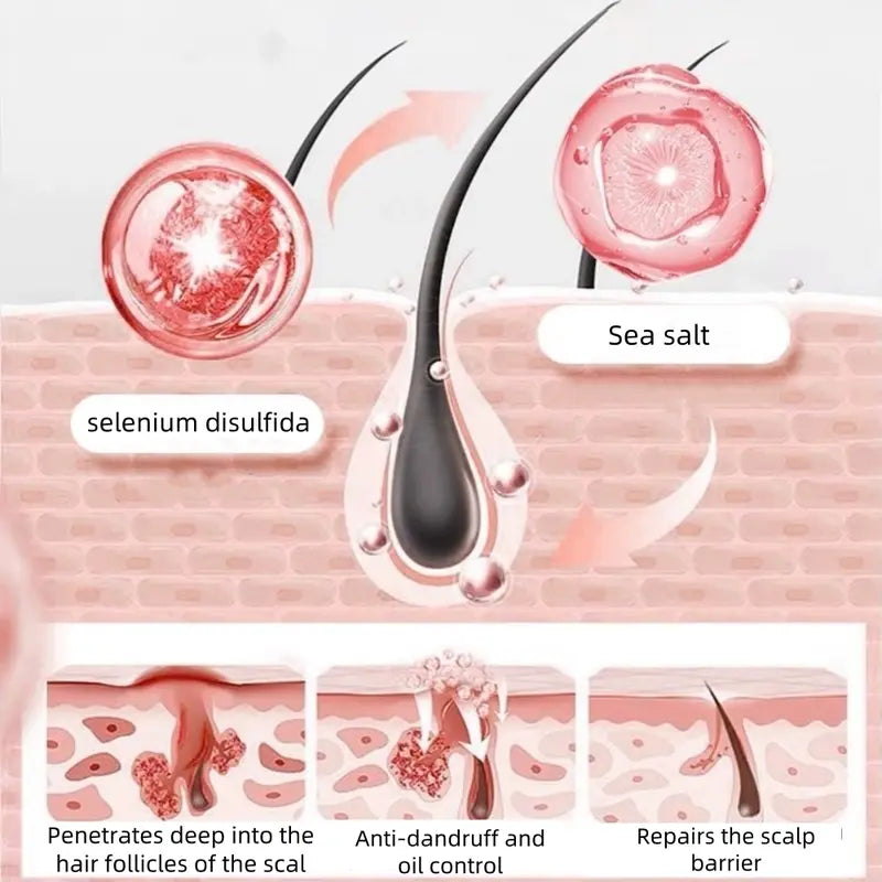 Champú capilar NIPPORI con disulfuro de selenio, control de aceite, refrescante, anticaspa, antipicazón y limpieza del cuero cabelludo, 300 ml