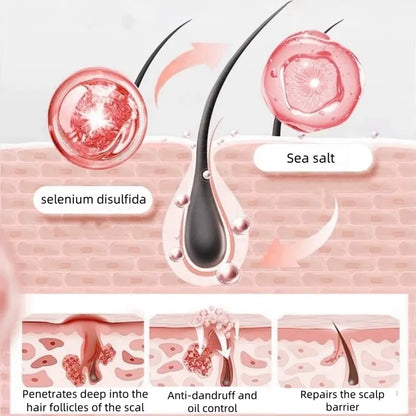 Champú capilar NIPPORI con disulfuro de selenio, control de aceite, refrescante, anticaspa, antipicazón y limpieza del cuero cabelludo, 300 ml