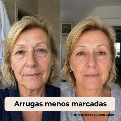 Naperi™ Crema Reinicio De Edad