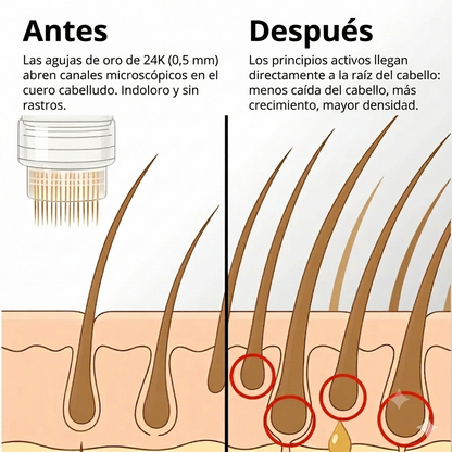 Sistema de crecimiento capilar Apex