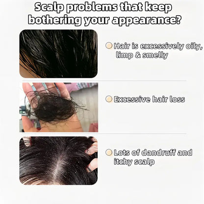 REMIMPI Champú anticaída, tratamiento para la caída del cabello, control de aceite, anticaspa, cuidado capilar, ginseng, jengibre, ayuda al crecimiento del cabello, jojoba, avena, repara, reduce la caída del cabello
