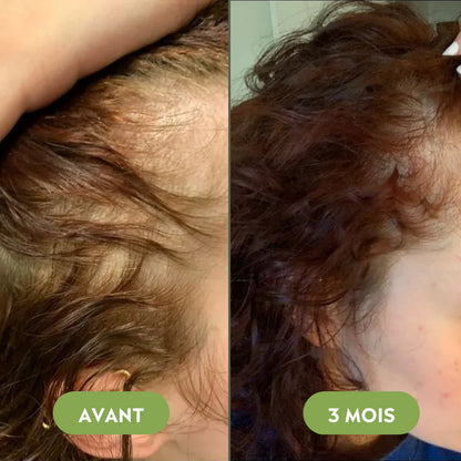 Sérum para el crecimiento del cabello (60 ml)