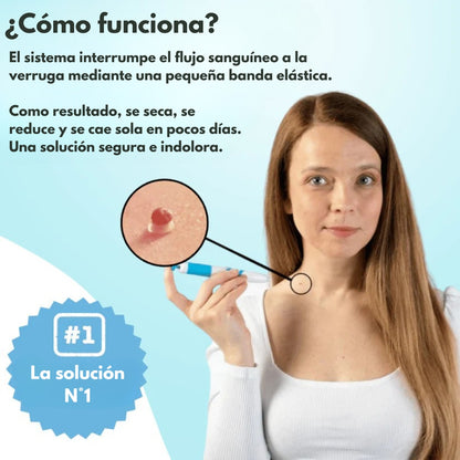 DermaSkin Pro™ - Dile adiós a las imperfecciones de la piel