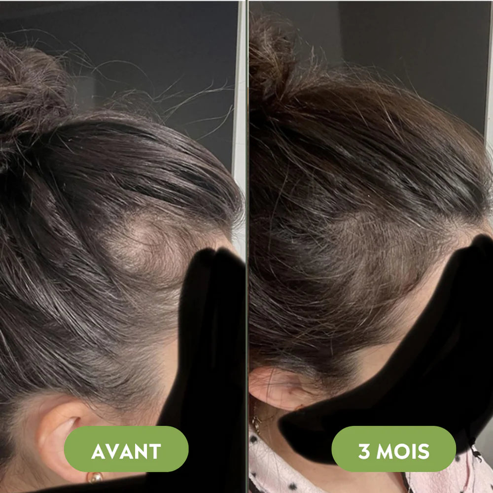 Sérum para el crecimiento del cabello (60 ml)