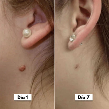 DermaSkin Pro™ - Dile adiós a las imperfecciones de la piel