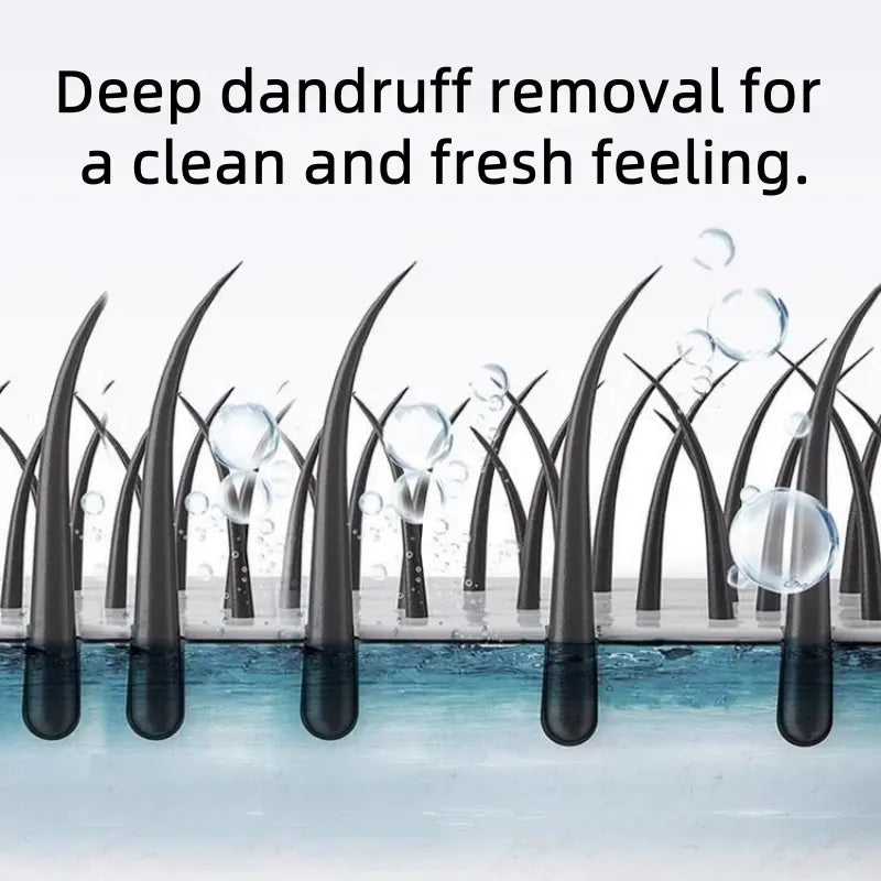 Champú capilar NIPPORI con disulfuro de selenio, control de aceite, refrescante, anticaspa, antipicazón y limpieza del cuero cabelludo, 300 ml