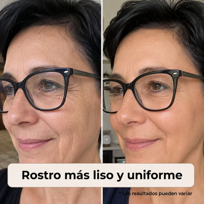 Naperi™ Crema Reinicio De Edad