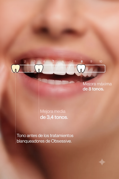 PURPLE V34 - Blanqueamiento Dental