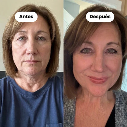 Banda Facial Sculpt de Colágeno