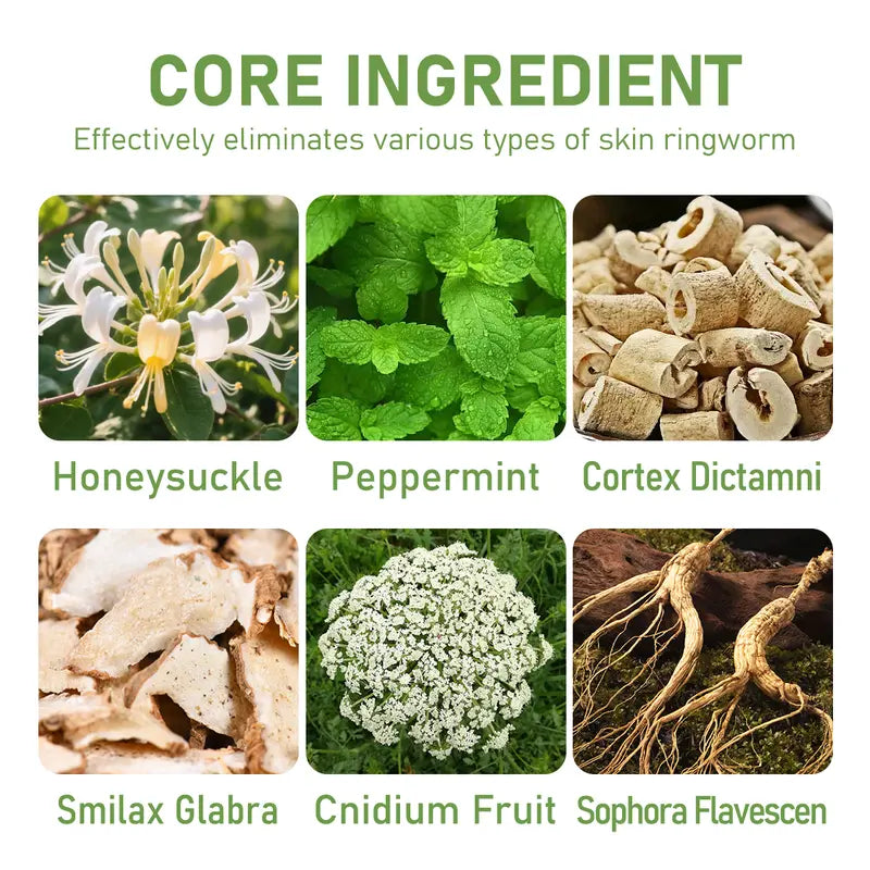 Crema de alivio herbal totalmente natural Umex a base de plantas: alivia el eccema, la psoriasis y la piel seca y sensible | Fórmula botánica ancestral para una hidratación diaria para toda la familia.