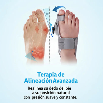 Naperi™: Sistema de Corrección del Juanete