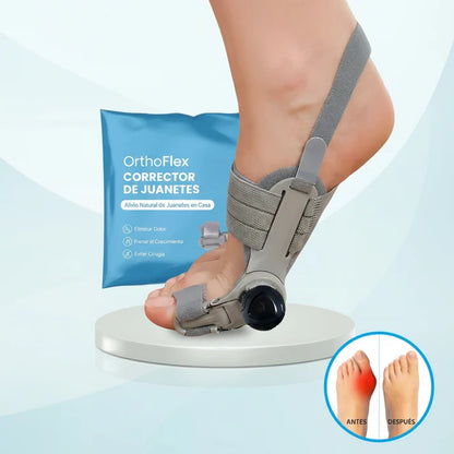 Naperi™: Sistema de Corrección del Juanete