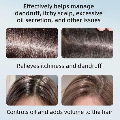 Champú capilar NIPPORI con disulfuro de selenio, control de aceite, refrescante, anticaspa, antipicazón y limpieza del cuero cabelludo, 300 ml