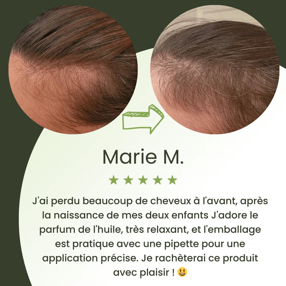 Sérum para el crecimiento del cabello (60 ml)