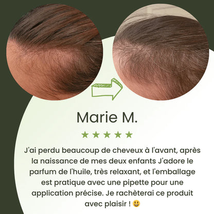 Sérum para el crecimiento del cabello (60 ml)
