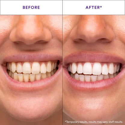 Blanqueador Dental Tiras Correctoras de Coloración Morado