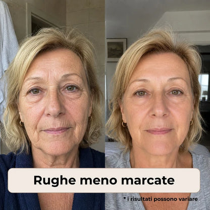 Naperi™ Crema Age Reset